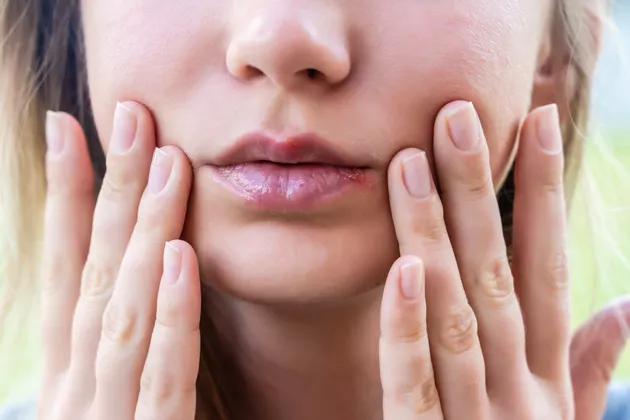تبخال یا جوش؟ چگونه تفاوتشان را تشخیص دهیم؟
