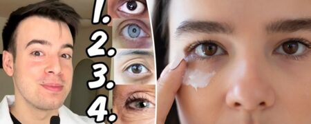 با انواع سیاهی زیر چشم و راه های رفع هر یک آشنا شوید