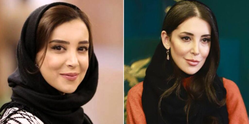 تغییر چهره عجیب سحر جعفری جوزانی بازیگر سریال‌های مهران مدیری