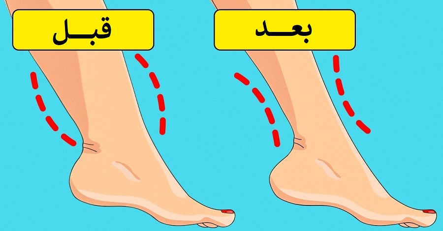 علت چاقی مچ پا چیست و چطور می توان آن را برطرف کرد؟