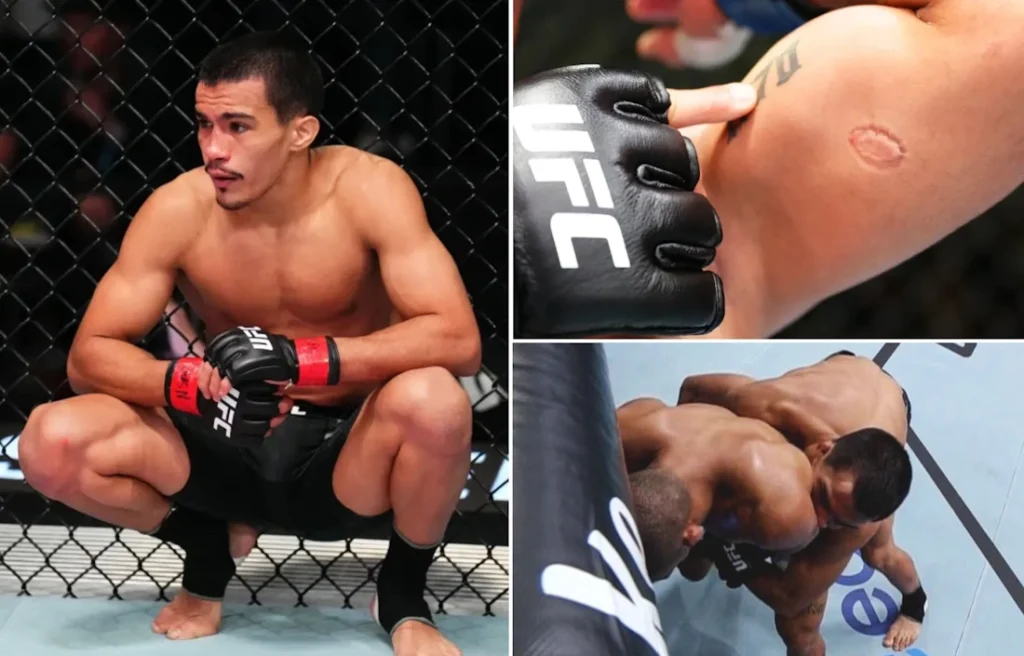 مبارز برزیلی به خاطر گاز گرفتن حریف در اولین مبارزه خود از UFC کنار گذاشته شد + ویدئو