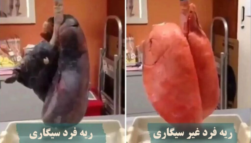 این ویدیوی تامل برانگیز میزان تخریب ریه‌ها توسط سیگار را نشان می‌دهد