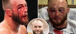 صورت متلاشی ماتئوش ربکی مبارز لهستانی UFC در اولین شکستش بعد از ۱۶ برد پیاپی
