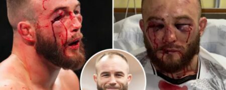 صورت متلاشی ماتئوش ربکی مبارز لهستانی UFC در اولین شکستش بعد از ۱۶ برد پیاپی